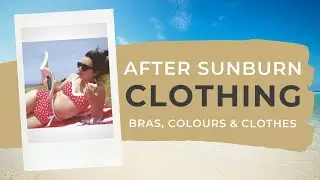What To Wear After Sunburn | Bra's, Colours & Comfort
