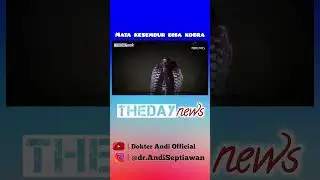 Mata Remaja ini Kesembur Bisa Kobra, Begini Keadaan Saat ini 