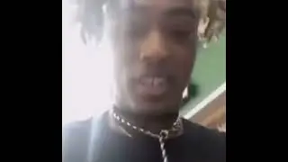 Where’s your hair baby?? / Xxxtentacion