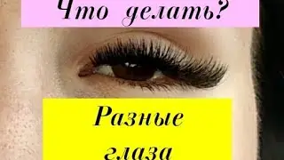 Разные глаза по форме и размеру.Не пропорциональность глаз.Кривые ресницы,не смыкание глаза....