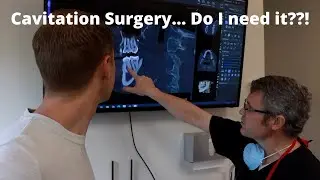 Cavitation Surgery Consult | Holistic Dentist Dr. Scott Chandler, DMD Summit View Biological Dentist