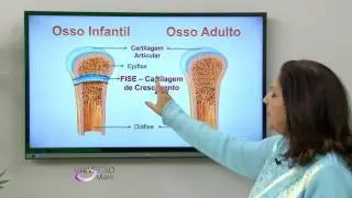 PUBERDADE PRECOCE