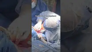 Ankle Fracture Surgery