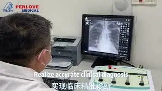 Installations of Perlove Medical Dynamic Flat Panel DRF