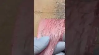 #депиляциябикини