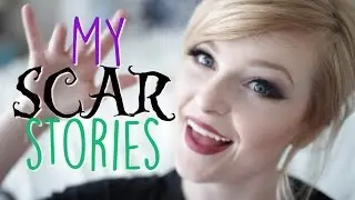 My Scar Stories | Fox & Crown