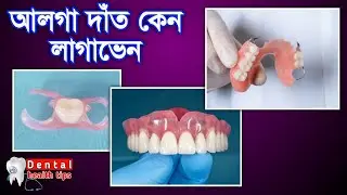 আলগা দাঁত কেন লাগাবেন, কিভাবে লাগাবেন || Teeth Denture @DentalHealthTips