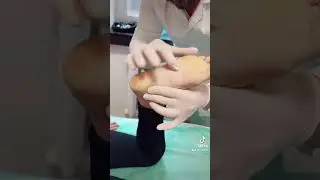 Foot correction