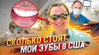 Стоматология в США цены. Российские дипломы в США. Страховка в США цена. Влог США.