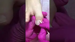 Педикюр 👣 #педикюр #ногти #nails #nailtutorial #мастерманикюра #beforeandafter