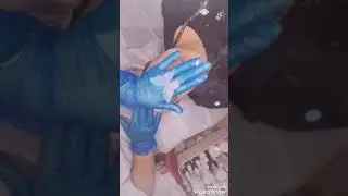 #טיפול פנים לעור זוהר