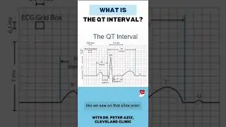 What is the QT interval?