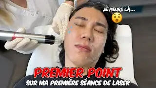 PREMIER POINT SUR MA PREMIÈRE SÉANCE DE LASER🔥