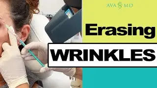 How To: Get Rid Of Fine Lines - Cosmetic Dermatology
