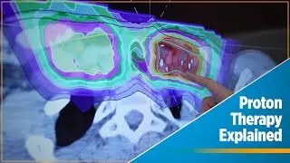 What is Proton Therapy? | Provision CARES Proton Therapy