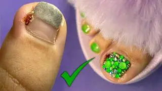 😱ЧТО С НОГТЕМ?! сделай чтобы НЕ ВИДНО! НОГТИ ПЕРЕВОПЛОЩЕНИЕ.ОШИБКИ в ПЕДИКЮРЕ.ПОСЛЕДСТВИЯ