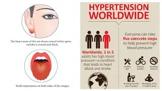 FACE READING FOR HYPERTENSION