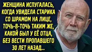Женщина была шокирована, когда увидела старика со следом, точь в точь таким же…