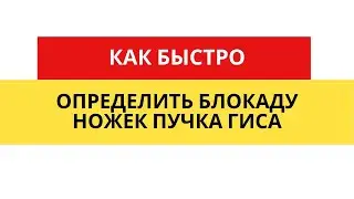 Как быстро отличить блокаду ножек пучка Гиса на ЭКГ?