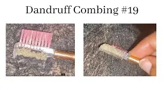 Dandruff combing #19