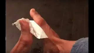 Foot Detox Iontophoresis Procedure Dr. Emilova Tsetsi. Йонофореза Детокс Процедура Др.Емилова Цеци