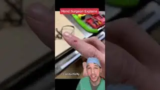 Protect your hands at all times! 