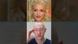 Did Gwen Stefani Have Plastic Surgery?