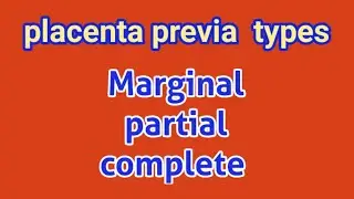 placenta previa || placenta previa minor, partial, complete, Totally during pregnancy