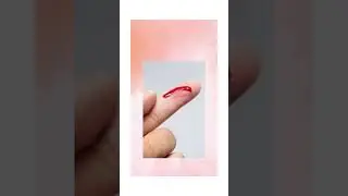 Penicillin Side Effects