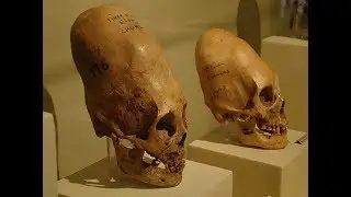 Skulls of unusual shapes. Directed by Tsareva.
