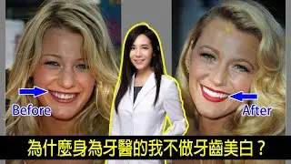 如何擁有像明星或網紅一樣的白牙？莫彩曦做了哪五件事來保養牙齒？我對牙齒美白的真實看法｜林榆芩醫師