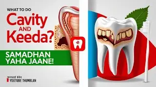Dant Me Cavity Aur Kida Lagne Par Kya Kare? Home Remedies & Expert Tips