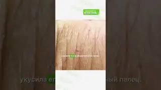 Змея укусила мужчину в собственной ванной #сша #происшествия