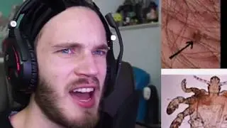 Things You Should Never Google (WARNING GROSS) #2 [PewDiePie - RUS RVV]