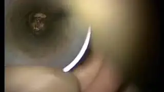Cerumen impaction removal