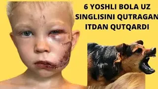 6 ЁШЛИ БОЛА КУТРАГАН ИТДАН СИНГЛИСИНИ КУТКАРДИ