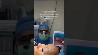 Ethnic rhinoplasty immediately post-op | Anthony Bared MD, FACS | Miami, FL