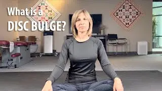 What is a Disc Bulge? by Irvine Posture & Movement Chiropractor