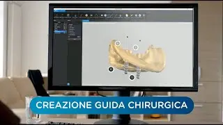 Chi è Implant 3D?