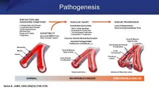 Pulmonary Arterial Hypertension: Addressing Diagnostic and Therapeutic Challenges