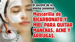 Mascarilla De Bicarbonato y Miel Para Quitar Manchas, Arrugas y Acné.