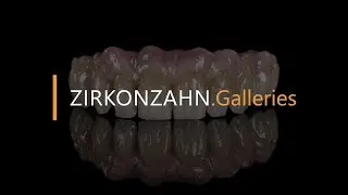 Prettau® Bridge in the maxilla on six implants | Zirkonzahn.Galleries