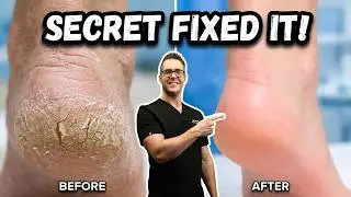 How to Remove Thick Dead Skin from Feet [+#1 BIG SECRET]