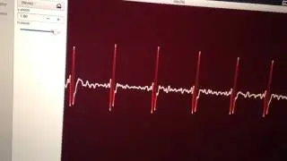 oscille