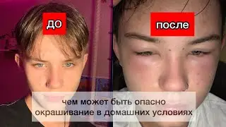 ОПУХОЛЬ ГОЛОВЫ ПОСЛЕ ОКРАШИВАНИЯ // неудачная смена имиджа