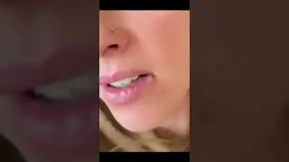 Blackhead King,  Week in Review  2