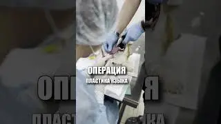 Прима порвала язык после драки с собакой... 