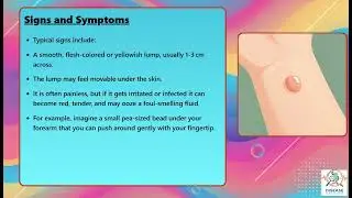 Sebaceous Cyst (Steatocystoma) Explained Causes, Symptoms and Treatment, All Insights