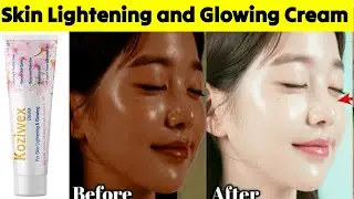 Best skin lightening & glowing cream| pigmentation cream| कालापन दूर करने वाला cream| Koziwex cream|