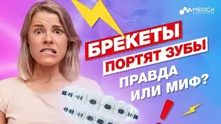 Портят ли брекеты зубы - ПРАВДА ИЛИ МИФ?// 